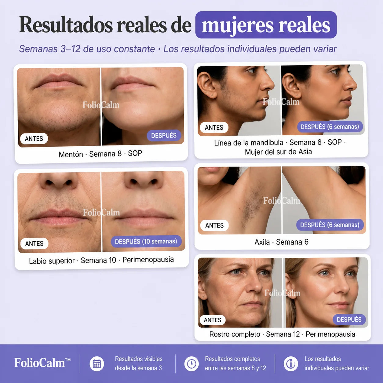 FolioCalm™ - Serum con Cyperus Rotundus